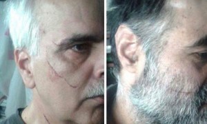 Saeed Razavi Faqih e Saeed Madani feriti al volto